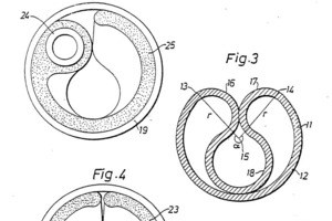  <div class="bildtext_en">Friction bolt: diagram from patent specification; 1980, Atlas Copco, Stockholm/S</div> 