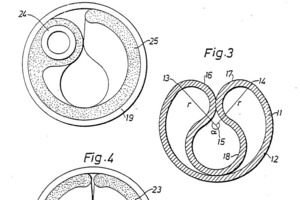  Friction bolt: diagram from patent specification; 1980, Atlas Copco, Stockholm/S 