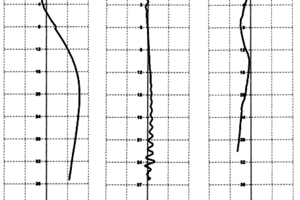  	Illustration of implausible axis deviations 